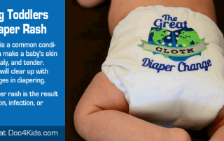 Treating-Toddlers-with-Diaper-Rash