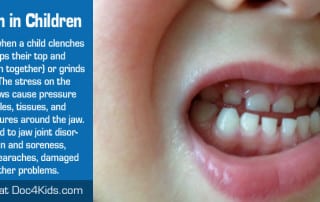 bruxism-in-children