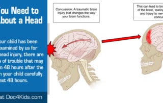 What You Need to Know About a Head Injury